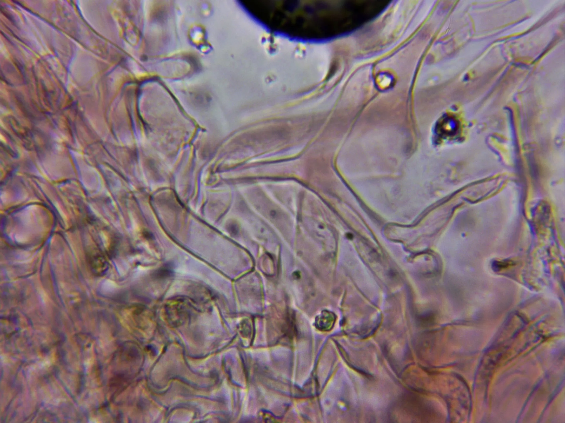Microscopía de Lactarius uvidus - 14 - Hifas cutícula ramificadas